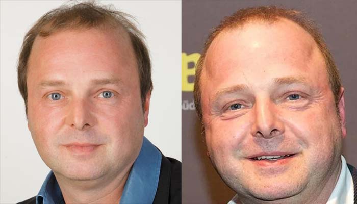 Wolfgang Feindt Todesursache – Was wirklich bekannt ist Wolfgang Feindt Todesursache